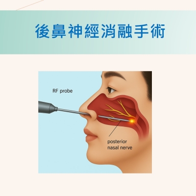 鼻炎手術